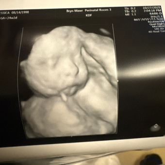 Babylist Registry Photo