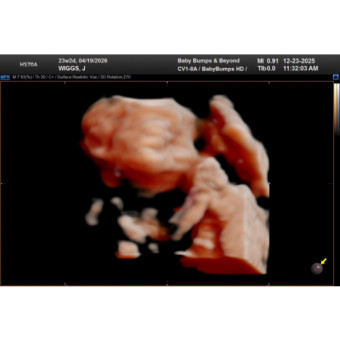 Babylist Registry Photo