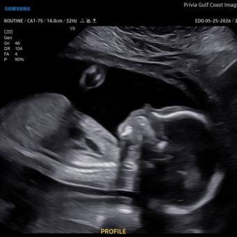 Babylist Registry Photo