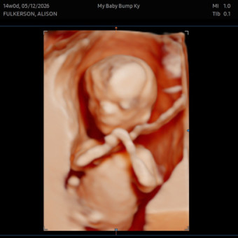 Babylist Registry Photo