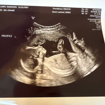 Babylist Registry Photo