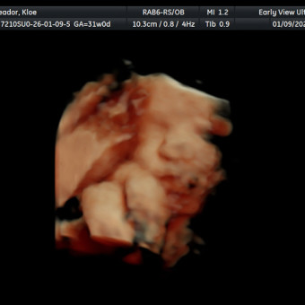 Babylist Registry Photo