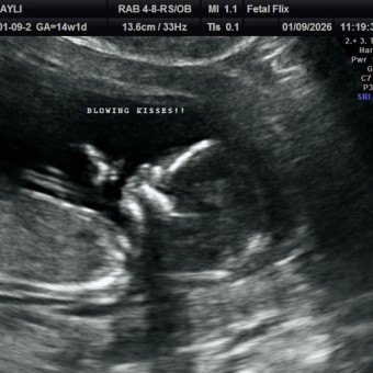 Babylist Registry Photo