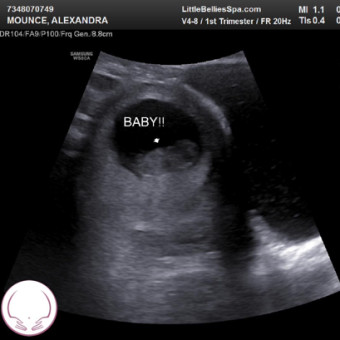 Babylist Registry Photo