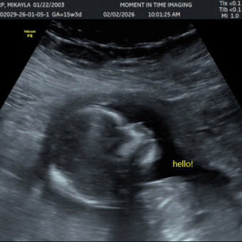 Babylist Registry Photo