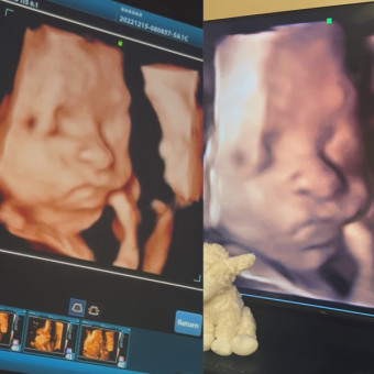 Babylist Registry Photo