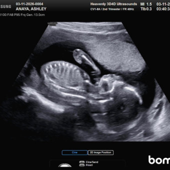 Babylist Registry Photo