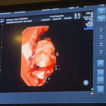 Babylist Registry Photo