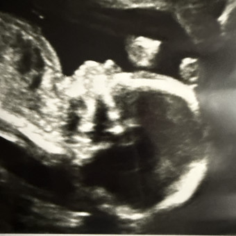 Nicole McRae-Guzman and Llan Guzman's Baby Registry at Babylist