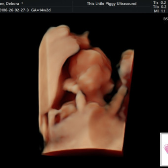 Babylist Registry Photo