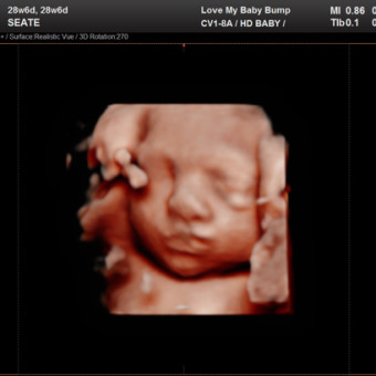 Babylist Registry Photo