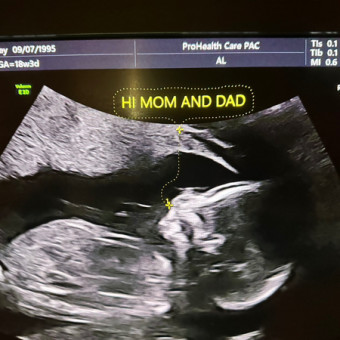 Babylist Registry Photo