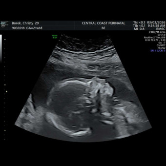 Babylist Registry Photo