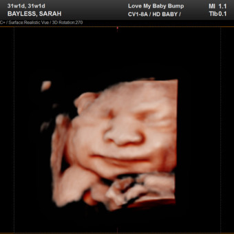 Babylist Registry Photo