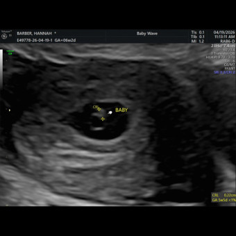 Babylist Registry Photo
