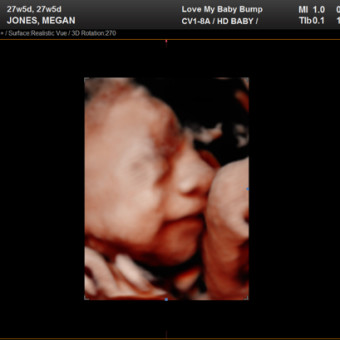 Babylist Registry Photo