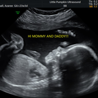Babylist Registry Photo
