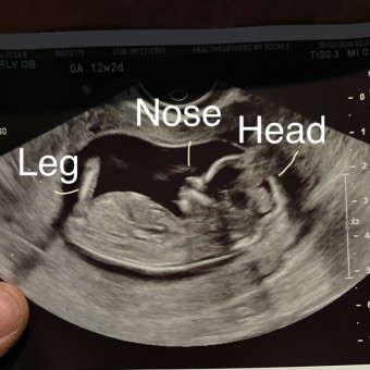Babylist Registry Photo