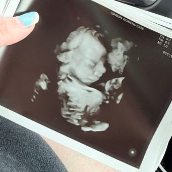 Babylist Registry Photo