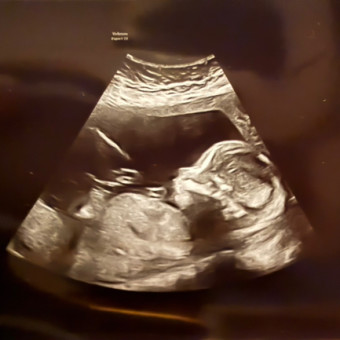 Sara Scarpelli’s Baby Registry at Babylist