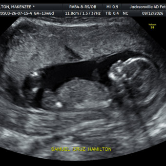 Babylist Registry Photo