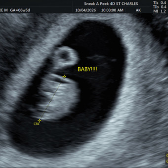 Babylist Registry Photo