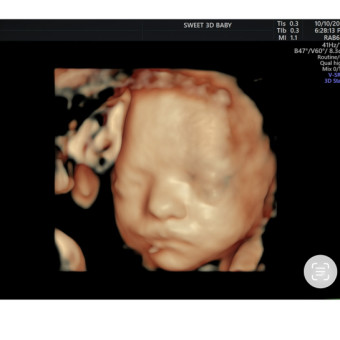 Babylist Registry Photo