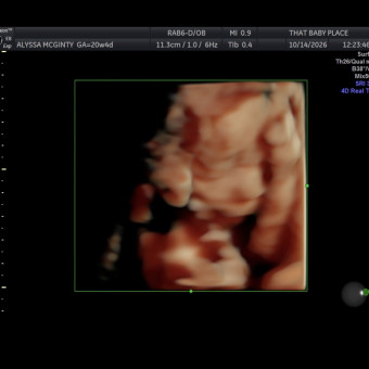 Babylist Registry Photo