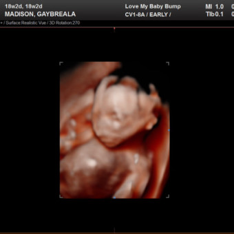 Babylist Registry Photo