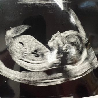 Babylist Registry Photo.