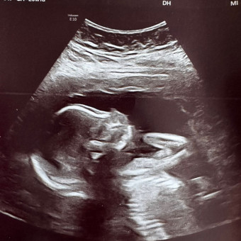 Babylist Registry Photo.